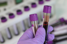 Bloedonderzoek in het lab: een linkerhand in een paarse laboratorium-handschoen houdt twee bloedbuisjes (met een paars dopje) vast. Op de achtergrond kun je (uit focus) meer buisjes zien liggen.