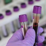 Bloedonderzoek in het lab: een linkerhand in een paarse laboratorium-handschoen houdt twee bloedbuisjes (met een paars dopje) vast. Op de achtergrond kun je (uit focus) meer buisjes zien liggen.